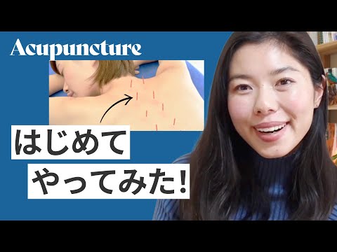 562 めまいが治った！体に鍼（はり）をさす治療って、こんな感じ！#日本語ポッドキャスト